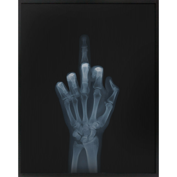 Framed Lenticular black and white x-ray photograph by Nick Veasey of a skeletal hand flipping the bird to the camera, middle finger is moving up and down 